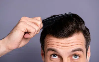 Was hilft gegen Haarausfall? Ursachen, Verlauf und Behandlungsmethoden